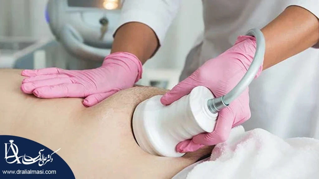 استفاده از دستگاه لاغری برای لاغری موضعی