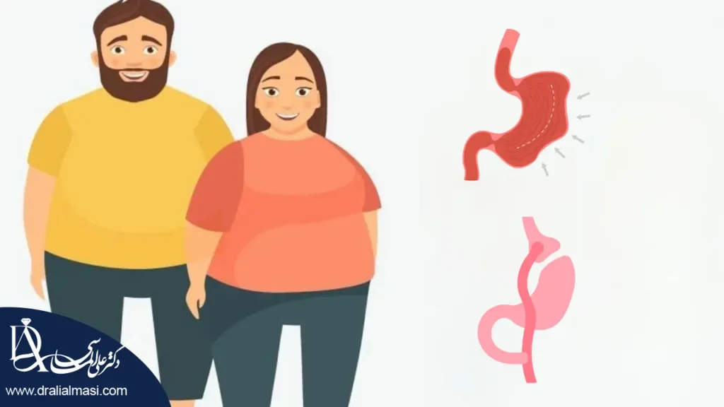 عکس گرافیکی که نشان دهنده بهترین روش لاغری برای افراد با چاقی مفرط است